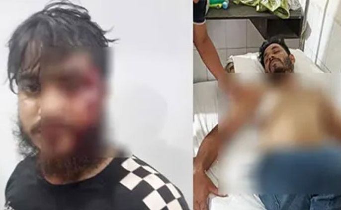 আখাউড়ায় জুয়াড়িদের হামলায় আহত ৩ ছাত্র-জনতা