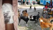 আখাউড়ায় কুকুরের কামড়ে আহত ৬