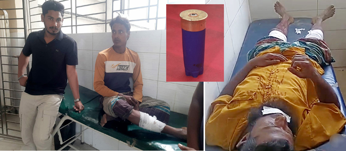 ব্রাহ্মণবাড়িয়ায় বালু উত্তোলনকে কেন্দ্র করে সশস্ত্র হামলায় চারজন গুলিবিদ্ধ
