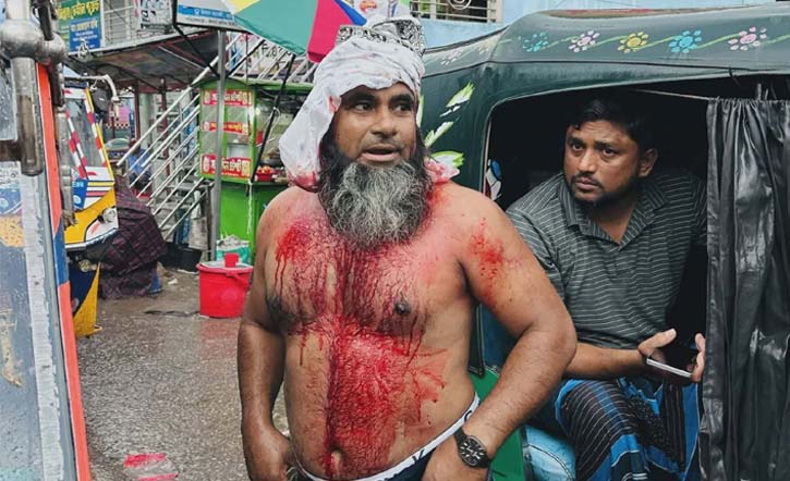 ব্রাহ্মণবাড়িয়ায় জমি নিয়ে বিরোধের জেরে এক ব্যক্তিকে কুপিয়ে জখম